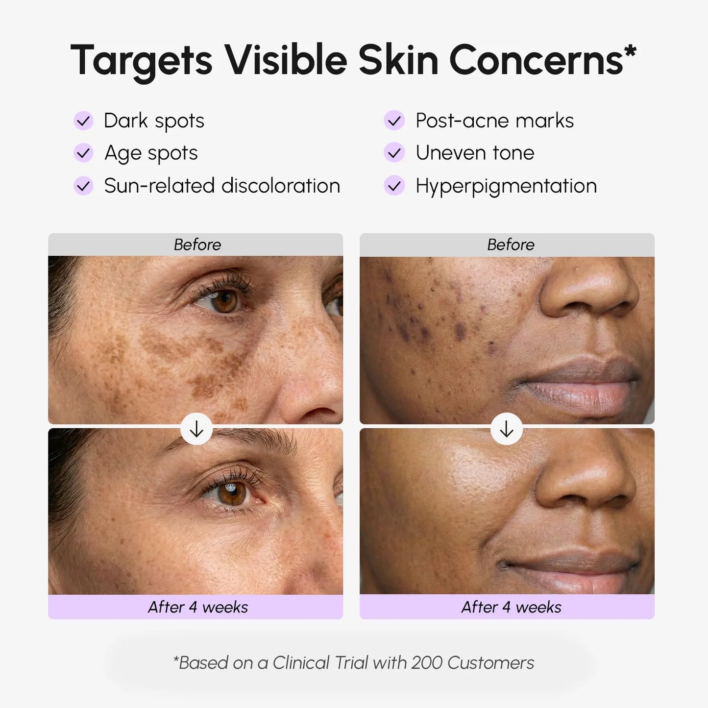 Dark Spot Corrector Serum with Vitamin C & Tranexamic Acid