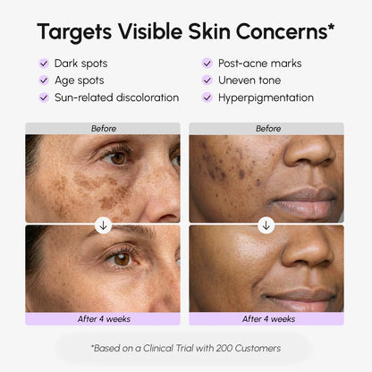 Dark Spot Corrector Serum with Vitamin C & Tranexamic Acid