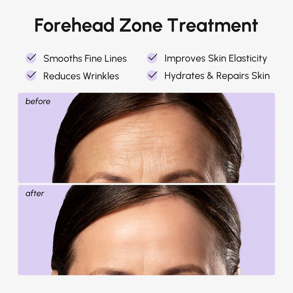 Anti-Wrinkle Forehead Patches – Overnight Smoothing Hydrogel Strips