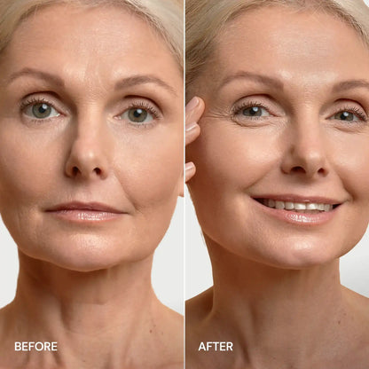 24K Gold V-Line Lifting Mask – Collagen Jawline & Neck Firming Mask (20 PCS)