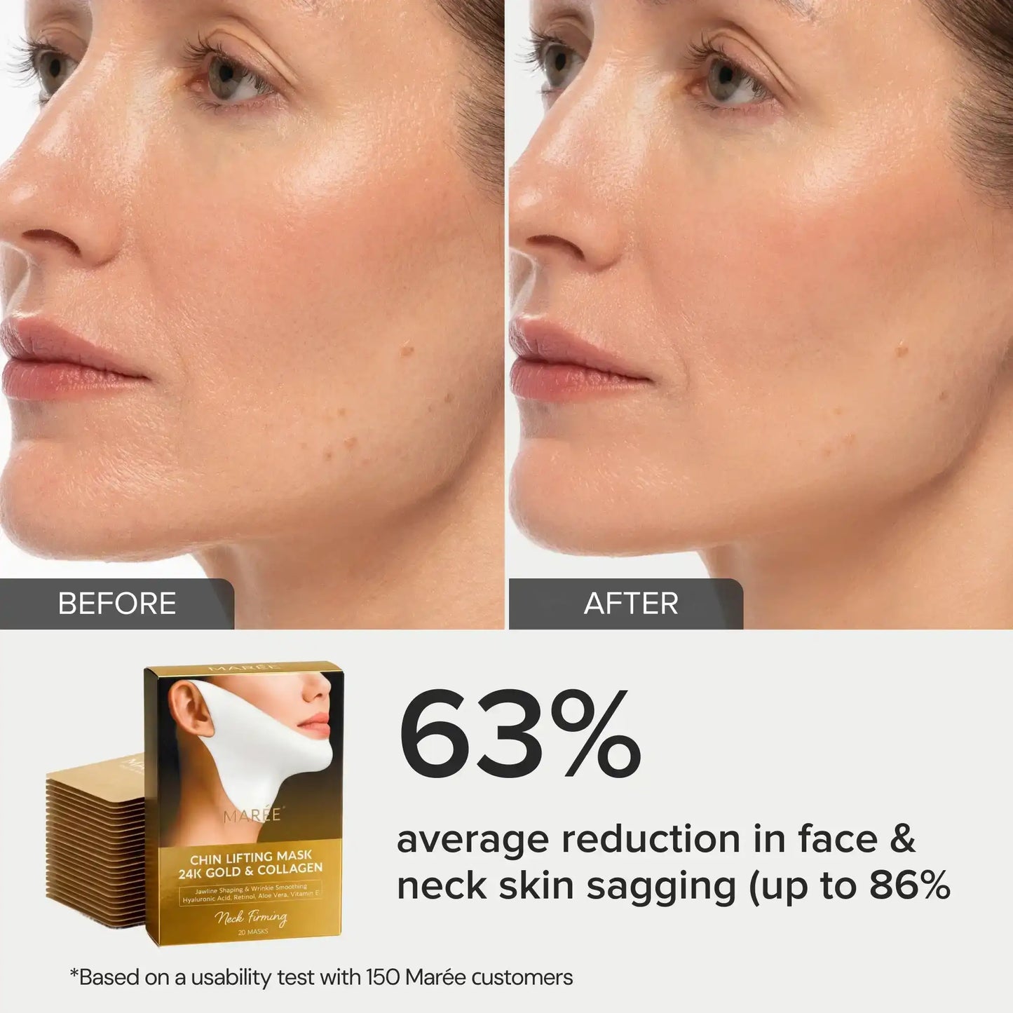 24K Gold V-Line Lifting Mask – Collagen Jawline & Neck Firming Mask (20 PCS)